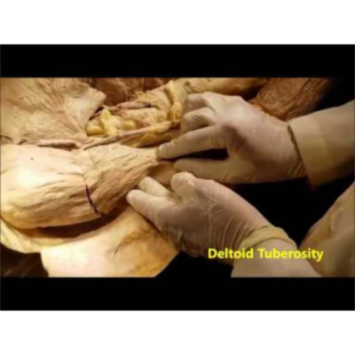 Deltoid Muscle and Axillary Nerve Dissection - Sanjoy Sanyal icon