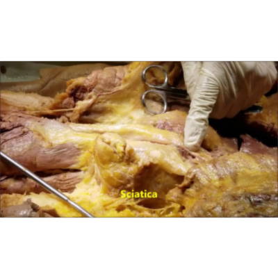 Sciatic Gluteal and Pudendal Nerves and Vessels in Gluteal Region – Sanjoy Sanyal icon