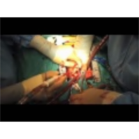 Warning: Graphic Content-Open Heart Surgery icon