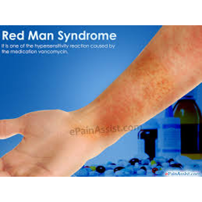 Red man syndrome icon