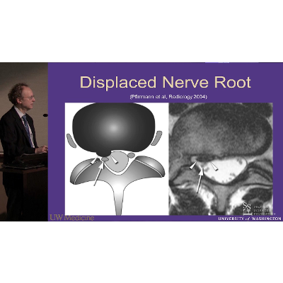 Lumbar MRI:  What the Findings Mean and How They Should Be Reported - J. Jarvik, MD, MPH icon