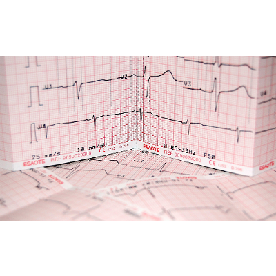 How to Read an EKG Strip in 5 Steps icon
