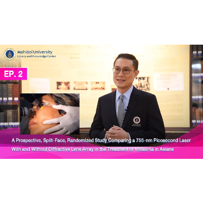 A study that demonstrates the result of picosecond laser for treatment of melasma up to 6 months after discontinuing the treatment. icon