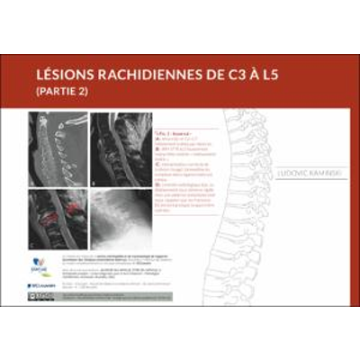 Lésions du rachis de C3 à L5 (Partie 2) icon