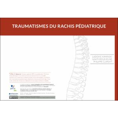 Les traumatismes du rachis pédiatrique icon
