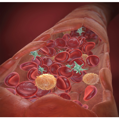 Extracorporeal membrane oxygenation: The nurse's role in... : Nursing2020 Critical Care icon