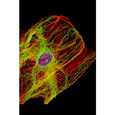 Review: Cytoskeleton: Actin, Intermediate...