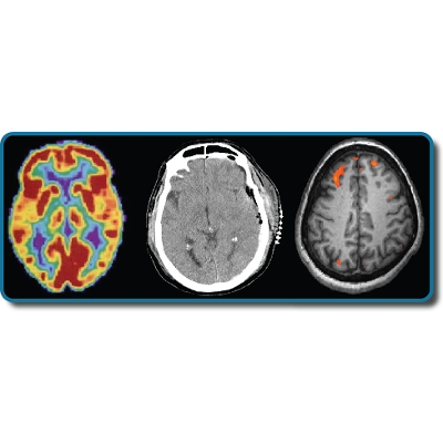 What Is Learning? - Psychology 2e | OpenStax icon