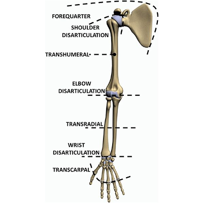 Frontiers | Literature Review on Needs of Upper Limb Prosthesis Users