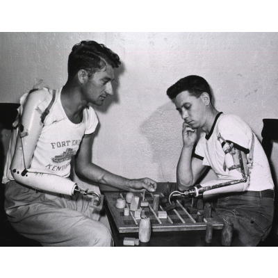 Prosthetics through the ages | NIH MedlinePlus Magazine