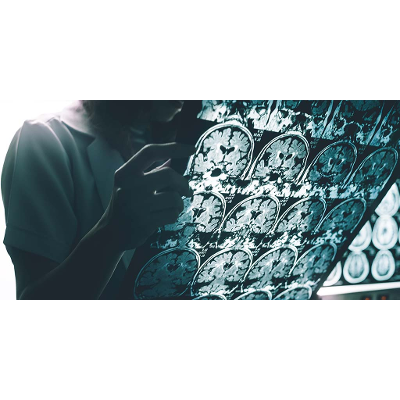 Neurodegenerative Diseases icon