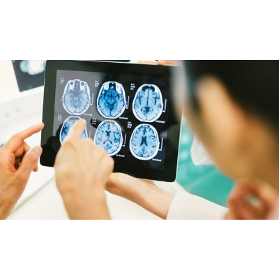 Brain Cancer Grades icon