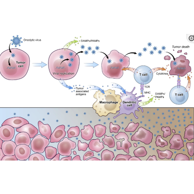 Viral Control of Glioblastoma