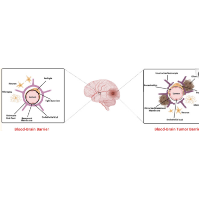 Exosomes: Promising Delivery Tools for Overcoming Blood-Brain Barrier and Glioblastoma Therapy icon