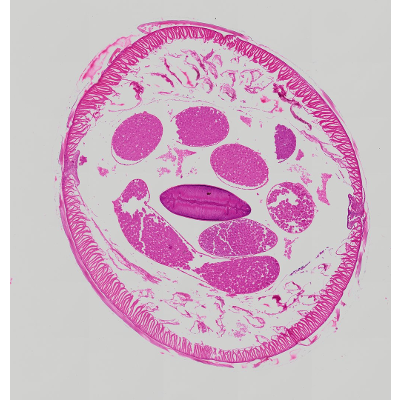 Ascaris Male Cross Section Under the Microscope · StudyScope icon