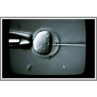 Mammalian Cloning and Stem Cell Therapy: Problems and Promise icon